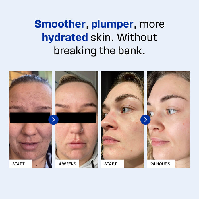 Boring Without You skincare for combination skin. 
  
 Clinically proven hydrating skincare. 

 Make Me Wet AQUAPORIN Hydrating Milk Serum. 
  
 Australian made skincare.

Hydrating skincare. brightening skincare. Hydrating serum