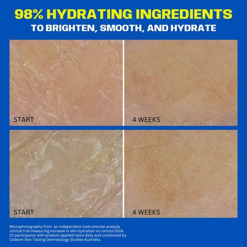 BORING WITHOUT YOU SKINCARE FOR COMBINATION SKIN MAKE_ME_WET_AQUAPORIN_HYDRATING_MILK_SERUM_MICRO_PHOTOGRAPHY_IMAGES_CLINICAL_TRIAL_
